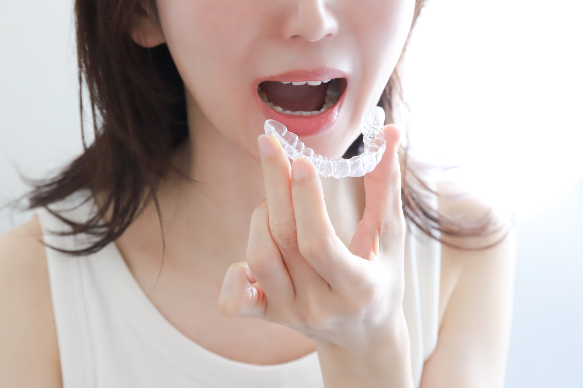 SureSmileアライナー