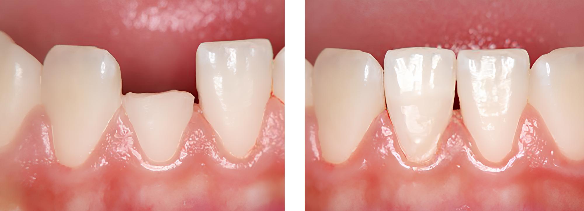 小児歯科 実例1