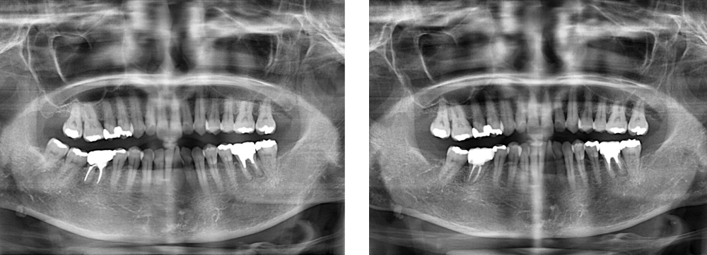 口腔外科 実例1