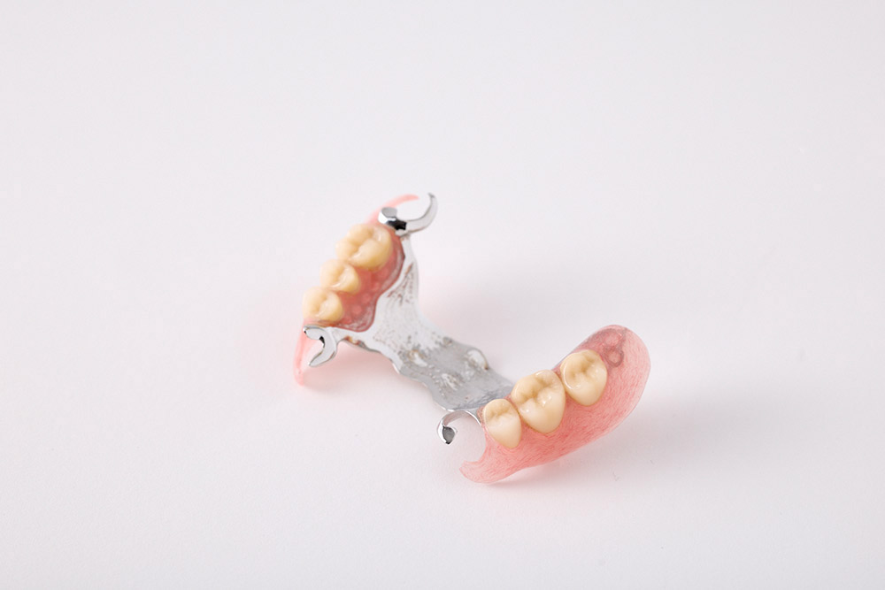 金属床義歯（コバルト・チタン・金合金）